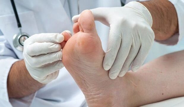 Behandlung und Diagnose von Pilzen durch einen Arzt