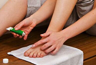 Auftragen einer Salbe zur Behandlung von Zehennagelpilz