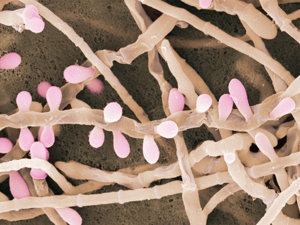 Trichophyton rubrum ist eine Pilzart, die die Haut der Füße befällt.